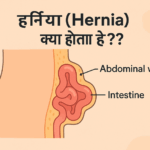 Harniya Kya Hota Hai