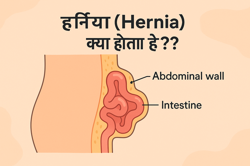 Harniya Kya Hota Hai